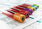 Inflammatory Markers in CAP Influenced by Time From Symptom Onset to Presentation Inflammatory Markers in CAP Influenced by Time From Symptom Onset to Presentation