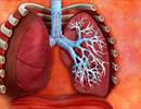 COPD Has Altered Deposition of Inhaled Nanoparticles COPD Has Altered Deposition of Inhaled Nanoparticles