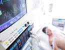 Mortality in Mechanically Ventilated Community-Acquired Pneumonia With or Without ARDS Mortality in Mechanically Ventilated Community-Acquired Pneumonia With or Without ARDS