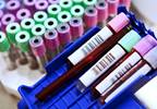 Pulmonary Hypertension Outcomes Predicted by NT-pro BNP Pulmonary Hypertension Outcomes Predicted by NT-pro BNP