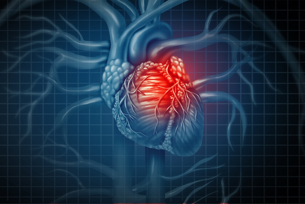 case-study-cardiovascular-complications-of-chronic-obstructive