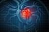 Cardiovascular Complications of COPD Cardiovascular Complications of COPD