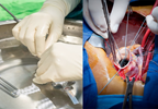 Transcatheter vs Surgical Aortic Valve Replacement in COPD Transcatheter vs Surgical Aortic Valve Replacement in COPD