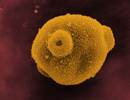 Birch Pollen-Related Foods Can Trigger Dermatitis Reactions Birch Pollen-Related Foods Can Trigger Dermatitis Reactions