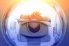 Low-Dose CT May Modify Pneumonia Diagnosis in Elderly Patients Low-Dose CT May Modify Pneumonia Diagnosis in Elderly Patients