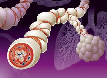COPD, Asthma, or Asthma COPD Overlap Syndrome: Diagnostic Challenges COPD, Asthma, or Asthma COPD Overlap Syndrome: Diagnostic Challenges