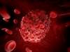 YEARS Criteria in Pulmonary Embolism Evaluation May Reduce Need for Imaging YEARS Criteria in Pulmonary Embolism Evaluation May Reduce Need for Imaging