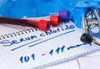 Serum Chloride Linked With Survival in Pulmonary Arterial Hypertension Serum Chloride Linked With Survival in Pulmonary Arterial Hypertension