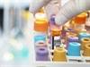 Type 2 Biomarkers May Predict Exacerbations in Severe Refractory Asthma Type 2 Biomarkers May Predict Exacerbations in Severe Refractory Asthma