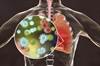 Budesonide Improved Epithelial Barrier Function in Asthma Budesonide Improved Epithelial Barrier Function in Asthma