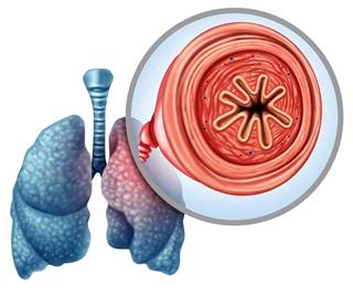 Like other inhalers, the product is classified by the FDA as a drug-device combination. Like other inhalers, the product is classified by the FDA as a drug-device combination.