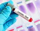 Delaying Lactate Draws in Sepsis Increases In-Hospital Death Risk Delaying Lactate Draws in Sepsis Increases In-Hospital Death Risk