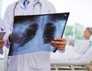 Community-Acquired Pneumonia In-Hospital Deaths Are Not Indicative of Lapse in Care Community-Acquired Pneumonia In-Hospital Deaths Are Not Indicative of Lapse in Care