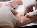 Subcutaneous Immunotherapy Shows Promise for Allergic Asthma Exacerbations Subcutaneous Immunotherapy Shows Promise for Allergic Asthma Exacerbations
