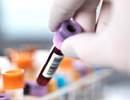 Free Vitamin D3 Inferior to Total Concentrations in Predicting Asthma Response Free Vitamin D3 Inferior to Total Concentrations in Predicting Asthma Response