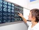 CT Bronchus Sign Improves Chance of Peripheral Pulmonary Lesion Diagnosis CT Bronchus Sign Improves Chance of Peripheral Pulmonary Lesion Diagnosis