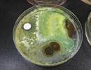 Severe Asthma Risk Increased From Aspergillus fumigatus Sensitization Severe Asthma Risk Increased From Aspergillus fumigatus Sensitization