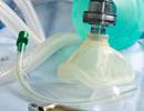 Extubation May Be Safe While on Vasoactive Infusions Extubation May Be Safe While on Vasoactive Infusions
