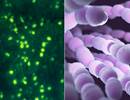Species-Specific Interactions of Common Bacteria in COPD Species-Specific Interactions of Common Bacteria in COPD