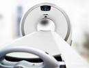 Early CT Detection of Small Cell Lung Cancer Does Not Improve Survival Rates Early CT Detection of Small Cell Lung Cancer Does Not Improve Survival Rates