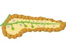 Ivacaftor Improves Insulin Secretion in Children With Cystic Fibrosis Ivacaftor Improves Insulin Secretion in Children With Cystic Fibrosis