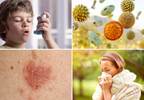 Relationship Between Atopic Disorders May Be Age Dependent Relationship Between Atopic Disorders May Be Age Dependent
