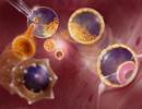 Adipose Tissue Transfer, Lung Scaffolds: The Future of Stem Cells in COPD Adipose Tissue Transfer, Lung Scaffolds: The Future of Stem Cells in COPD
