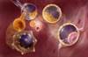 Adipose Tissue Transfer, Lung Scaffolds: The Future of Stem Cells in COPD Adipose Tissue Transfer, Lung Scaffolds: The Future of Stem Cells in COPD