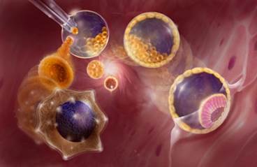 Adipose Tissue Transfer, Lung Scaffolds: The Future of Stem Cells in COPD Adipose Tissue Transfer, Lung Scaffolds: The Future of Stem Cells in COPD