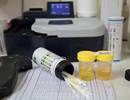 Albuminuria Associated With Lung Function Decline in COPD Albuminuria Associated With Lung Function Decline in COPD