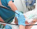 Remimazolam Safe, Effective for Sedation During Flexible Bronchoscopy Remimazolam Safe, Effective for Sedation During Flexible Bronchoscopy