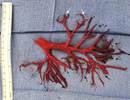 Heart Failure Patient Coughs Up Bronchial Tree-Shaped Blood Clot Heart Failure Patient Coughs Up Bronchial Tree-Shaped Blood Clot