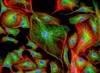 Endothelial Colony Forming Cells in PAH Restore Myocardial Vascular Density Endothelial Colony Forming Cells in PAH Restore Myocardial Vascular Density