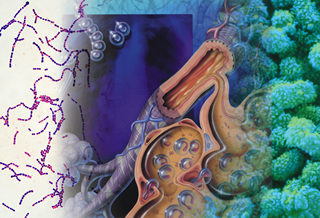 Immunosuppression and aging are the leading factors for patient outcomes in influenza coinfection. Immunosuppression and aging are the leading factors for patient outcomes in influenza coinfection.