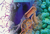 Bacterial Pneumonia-Complicating Influenza: Risks, Morbidity, and Mortality Bacterial Pneumonia-Complicating Influenza: Risks, Morbidity, and Mortality