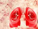 Indacaterol/Glycopyrronium Improves Regional Ventilation in COPD Indacaterol/Glycopyrronium Improves Regional Ventilation in COPD