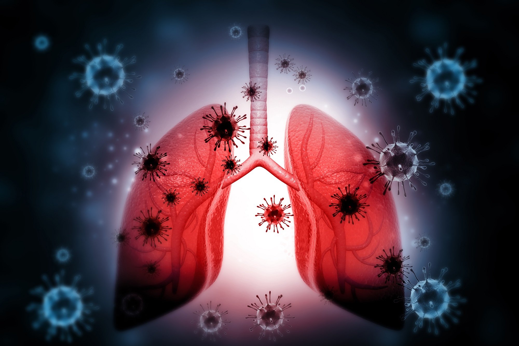 What Causes Lung Infection In Children