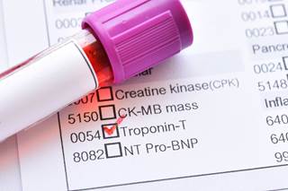 Although the methods used to detect serum cardiac troponin were not consistent, positive serum cardiac troponin was present in many patients. Although the methods used to detect serum cardiac troponin were not consistent, positive serum cardiac troponin was present in many patients.