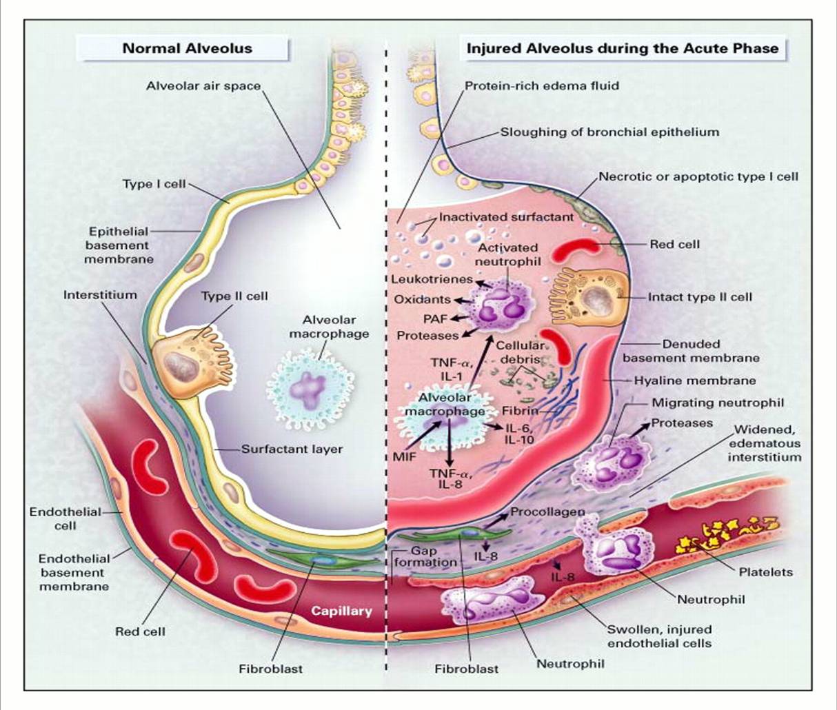 dead space in lung